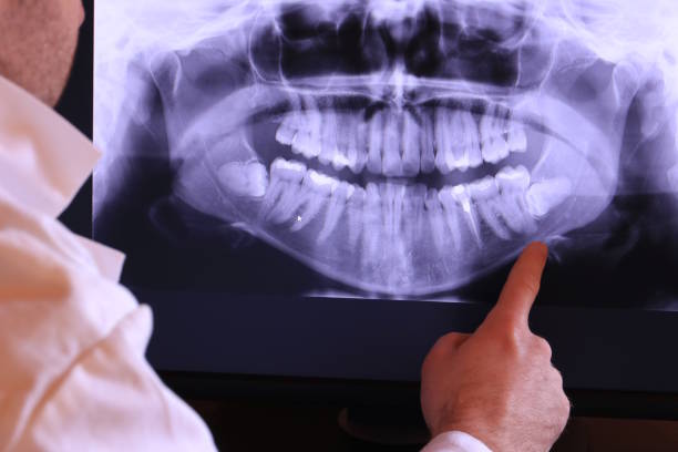 Best Emergency Broken Tooth Repair in Breckenridge, TX