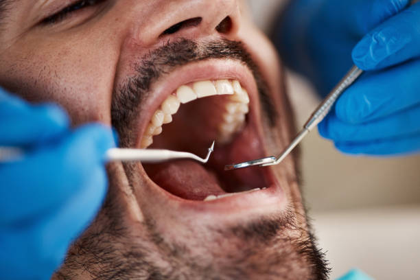 Best Walk-In Emergency Dentist in Breckenridge, TX