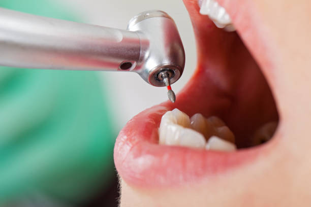 Best Walk-In Emergency Dentist in Breckenridge, TX